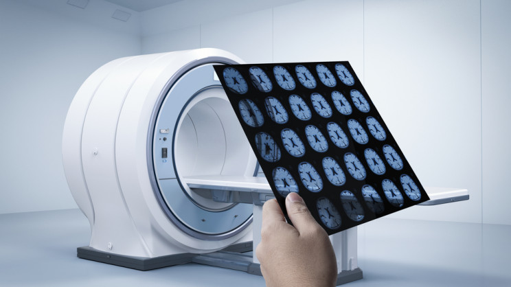 Importation of MRI scanners to become simpler image 1